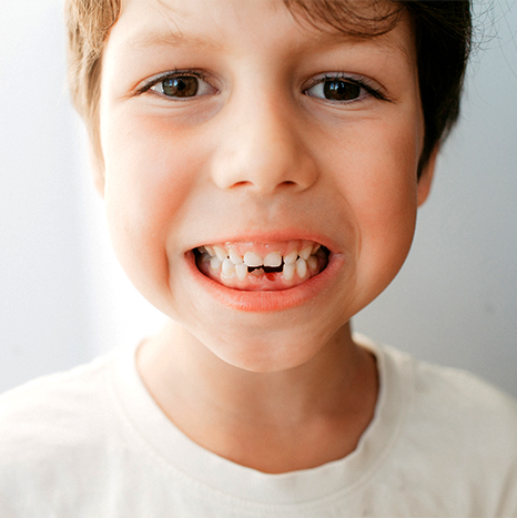 Pediatric Dentistry - Child with Smile