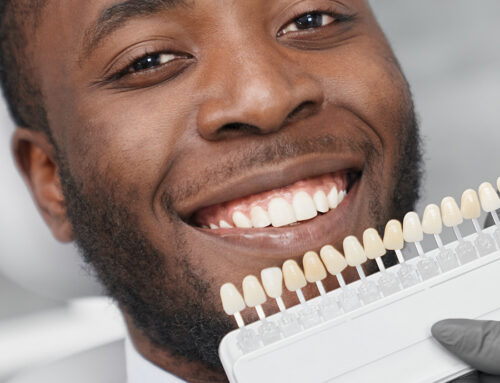 The Secret to a Perfect Smile: Why Veneers Are a Game-Changer