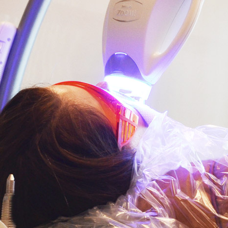 Teeth Whiteningy by Dr. Tyler Hicks